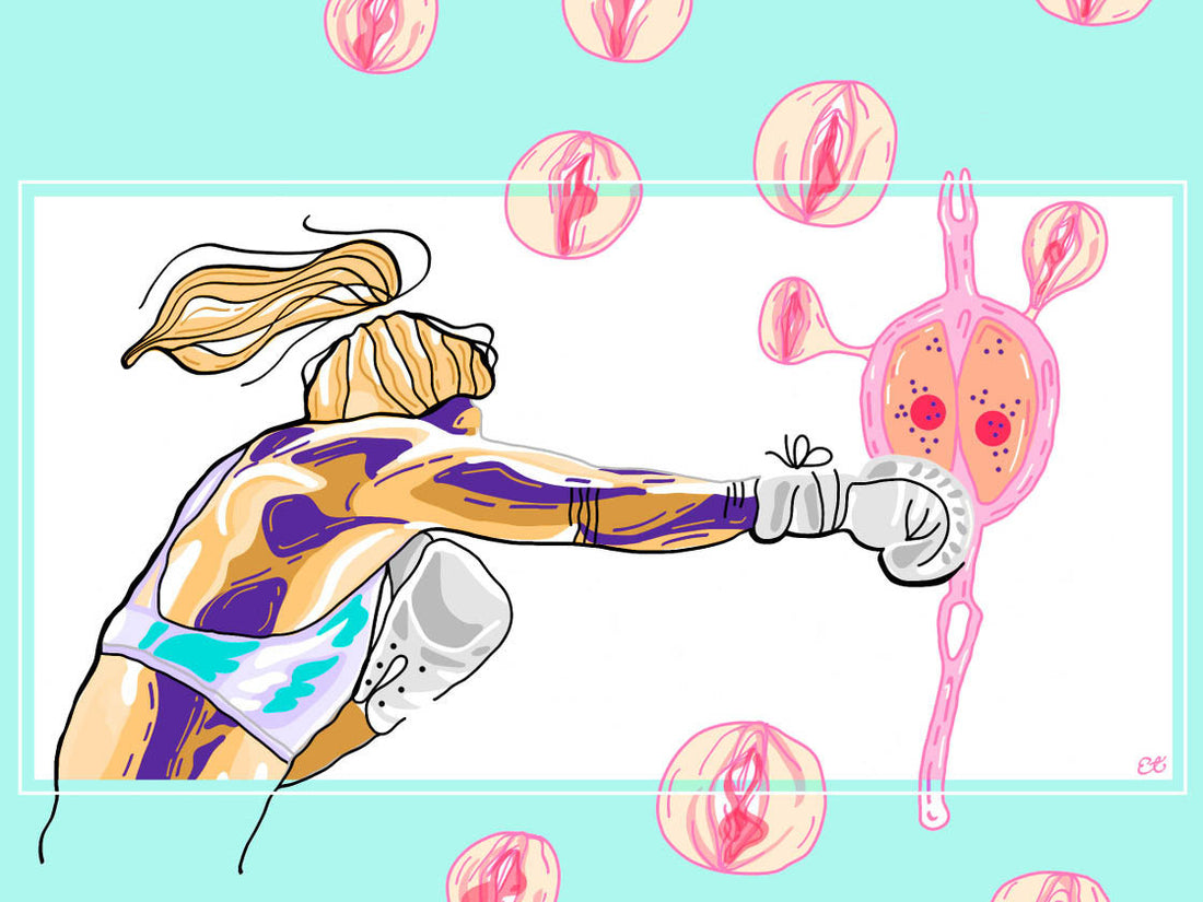 Yeast Infection and Periods